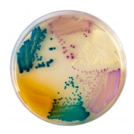 CHROMagar Orientation (1L)
