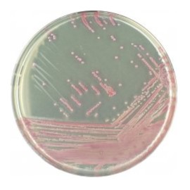 CHROMagar MRSA (1L)