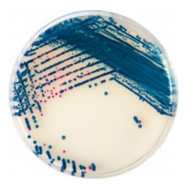 CHROMagar StrepB (5L)